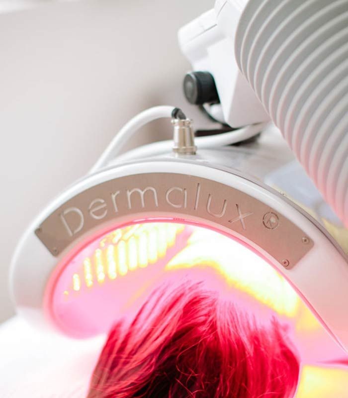 LED phototherapy device labeled 'Dermalux' with pink light illuminating a person's hair.